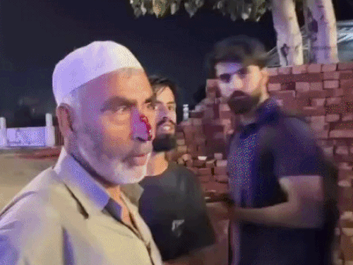 करनाल में श्रीनगर जा रही बस पर पथराव, एक घायल:कार टच होने पर विवाद; जम्मू-कश्मीर CM बोले- यह दुर्भाग्यपूर्ण, कार्रवाई होनी चाहिए