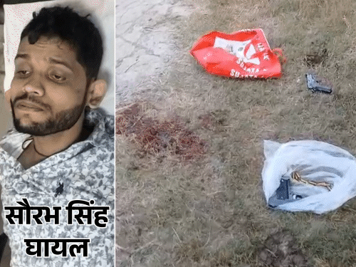 पटना में मर्डर के आरोपी का एनकाउंटर:पुलिस ने दौड़ाकर पैर में मारी गोली; बीच सड़क गैराज मालिक की गोली मारकर की थी हत्या
